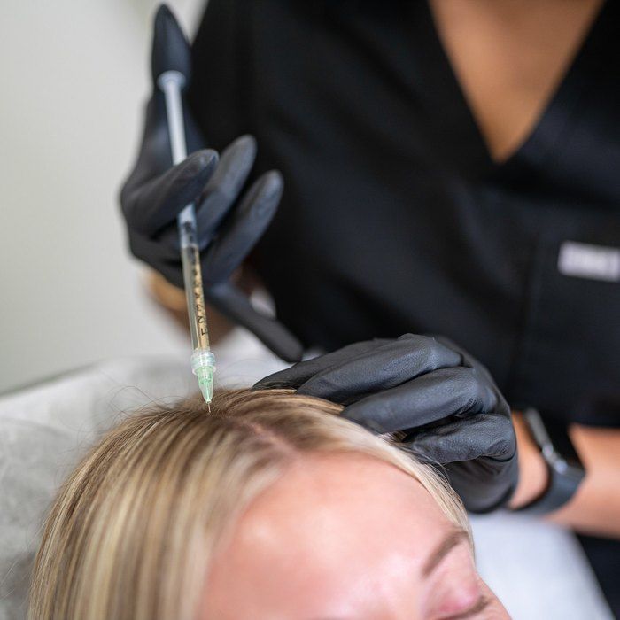 PRP Hair Restoration